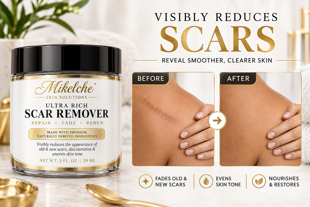Mikelche Essential Oils Scar Remover