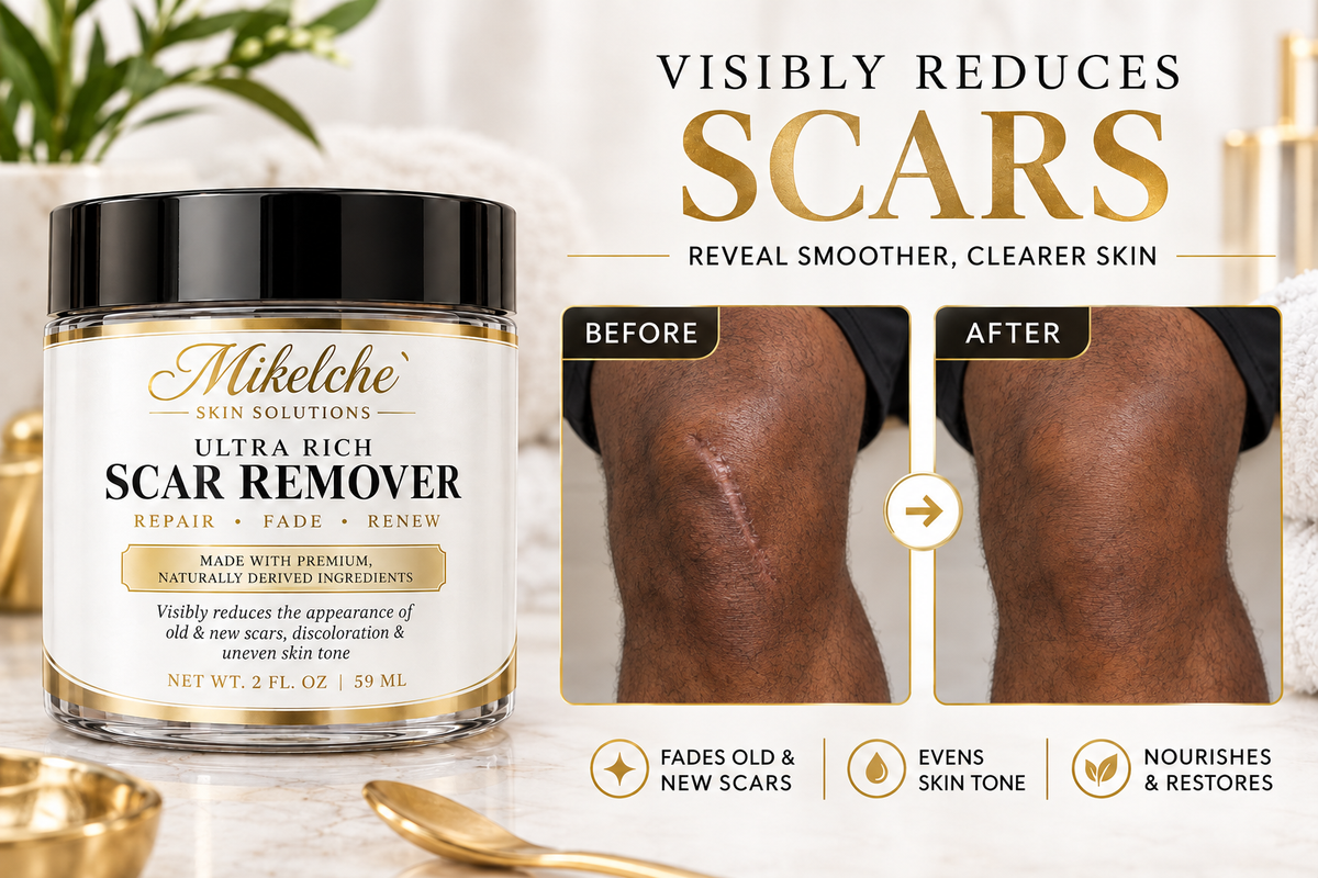 Mikelche Essential Oils Scar Remover