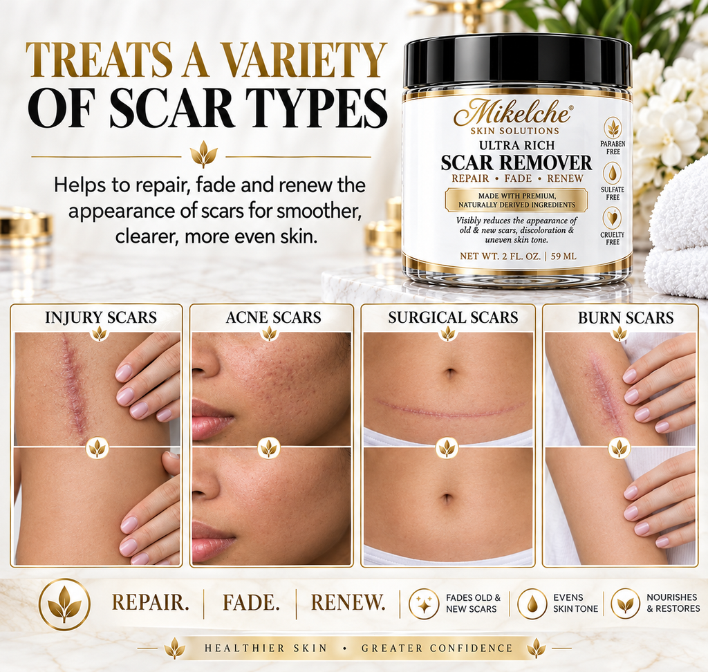 Mikelche Essential Oils Scar Remover